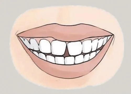 <a href=http://m.mkvu.com.cn/news_article?news_id=116>一次性口腔探針</a>